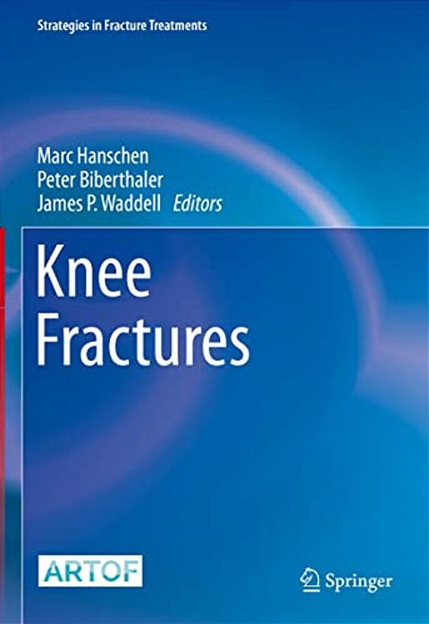 Knee Fractures-..