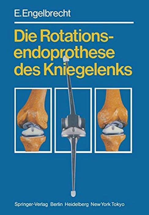 Die Rotationsendoprothese Des Kniegelenks-..