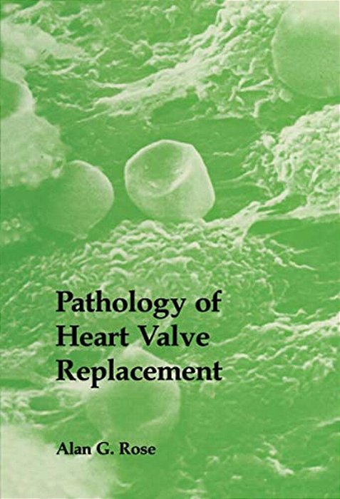 Pathology Of Heart Valve Replacement-..