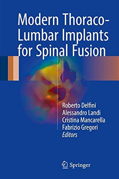 Modern Thoraco-Lumbar Implants For Spinal Fusion-..