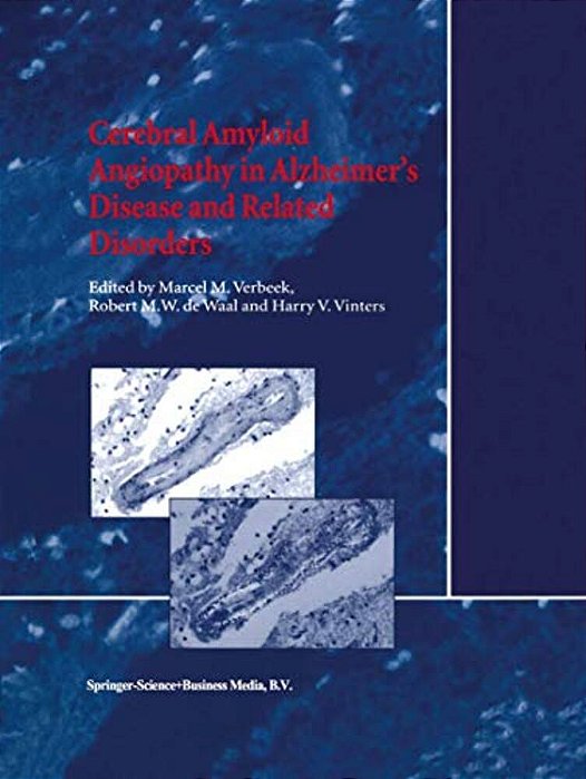 Cerebral Amyloid Angiopathy In Alzheimer's Disease And Related Disorders-..