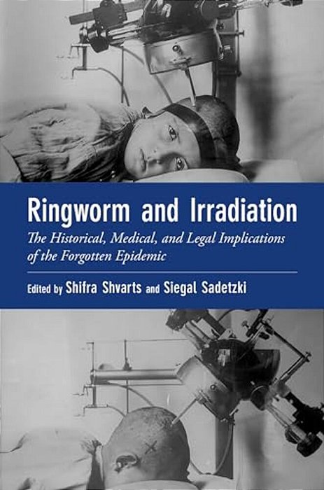 Ringworm And Irradiation: The Historical, Medical, And Legal Implications Of The Forgotten Epidemic-..