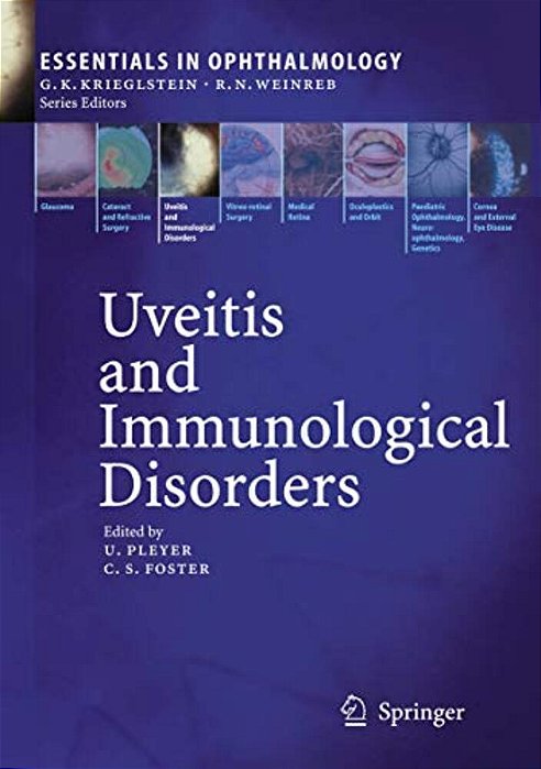 Uveitis And Immunological Disorders-..