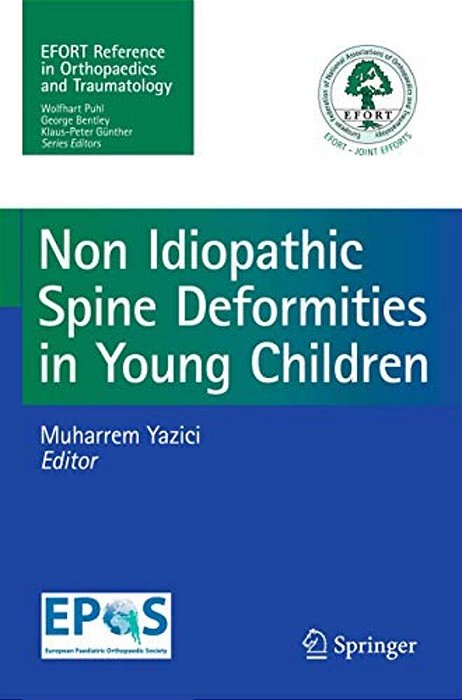 Non-Idiopathic Spine Deformities In Young Children-..