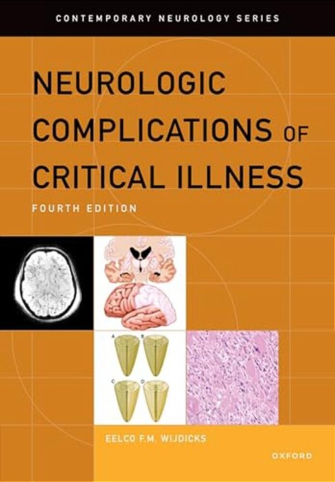 Neurologic Complications Of Critical Illness-..