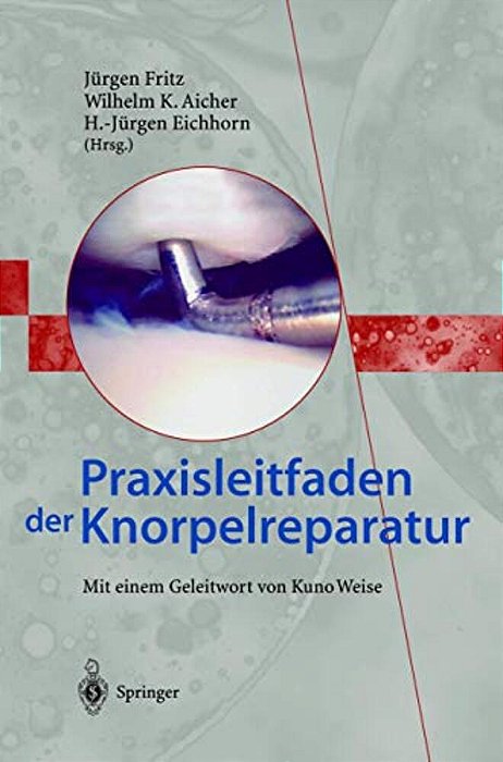 Praxisleitfaden Der Knorpelreparatur-..