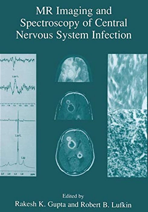 Mr Imaging And Spectroscopy Of Central Nervous System Infection-..