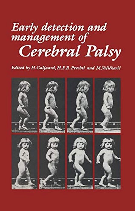 Early Detection And Management Of Cerebral Palsy-..