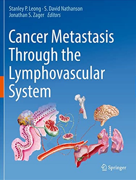Cancer Metastasis Through The Lymphovascular System-..