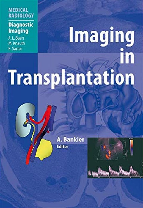 Imaging In Transplantation-..