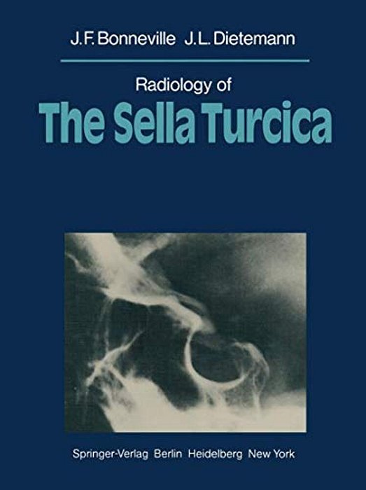 Radiology Of The Sella Turcica-..