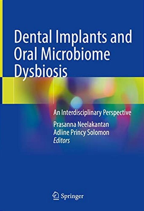 Dental Implants And Oral Microbiome Dysbiosis: An Interdisciplinary Perspective-..