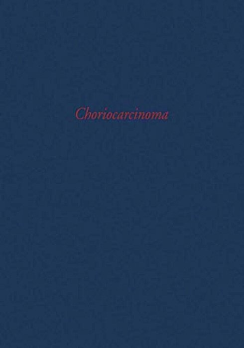 Choriocarcinoma: Transactions Of A Conference Of The International Union Against Cancer-..