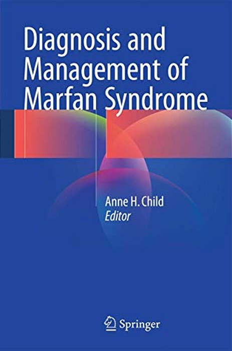 Diagnosis And Management Of Marfan Syndrome-..