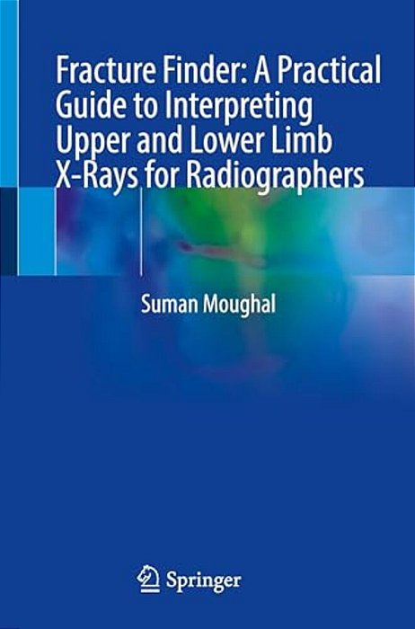 Fracture Finder: A Practical Guide To Interpreting Upper And Lower Limb X-Rays For Radiographers-..