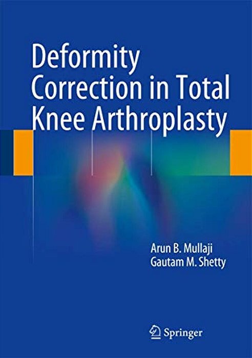 Deformity Correction In Total Knee Arthroplasty-..
