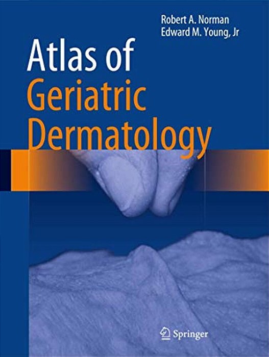 Atlas Of Geriatric Dermatology-..