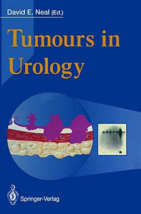 Tumours In Urology-..