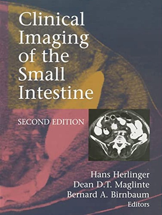 Clinical Imaging Of The Small Intestine-..