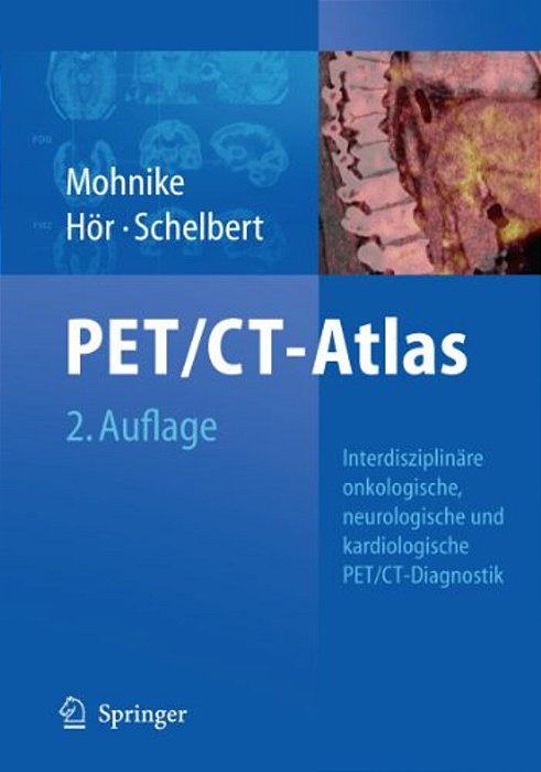 Oncologic And Cardiologic Pet/Ct-Diagnosis: An Interdisciplinary Atlas And Manual [With Dvd ROM]-..