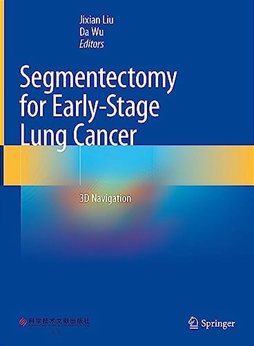 Segmentectomy For Early-Stage Lung Cancer: 3D Navigation-..