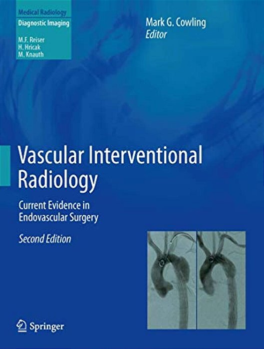 Vascular Interventional Radiology: Current Evidence In Endovascular Surgery-..