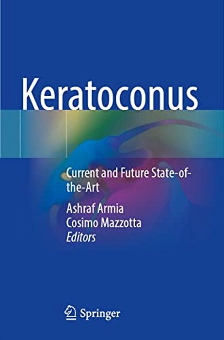 Keratoconus: Current And Future State-Of-the-art-..
