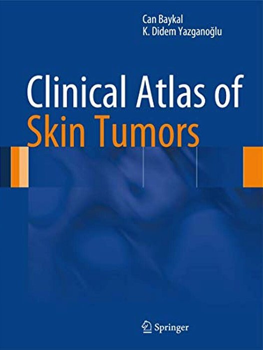 Clinical Atlas Of Skin Tumors-..