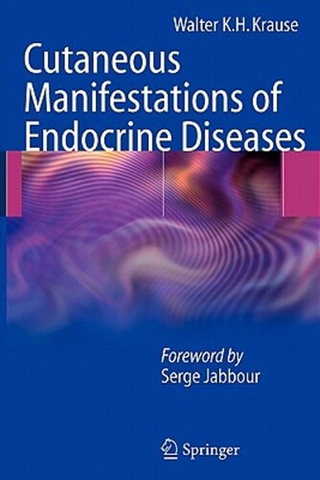 Cutaneous Manifestations Of Endocrine Diseases-..