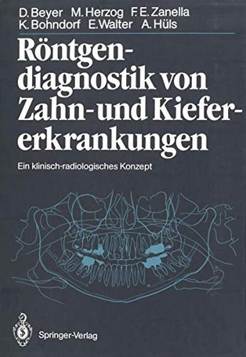 Röntgendiagnostik Von Zahn- Und Kiefererkrankungen: Ein Klinisch-Radiologisches Konzept-..