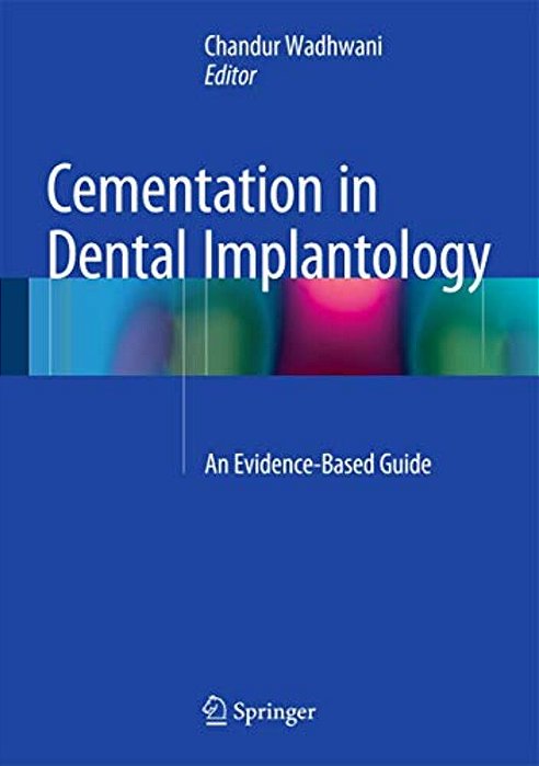 Cementation In Dental Implantology: An Evidence-Based Guide-..