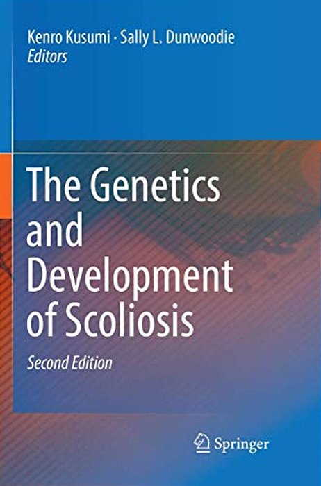 The Genetics And Development Of Scoliosis-..