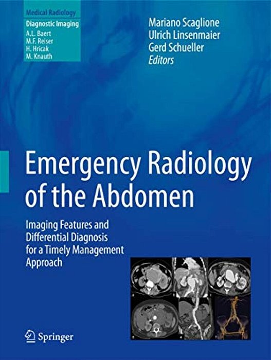 Emergency Radiology Of The Abdomen: Imaging Features And Differential Diagnosis For A Timely Management Approach-..