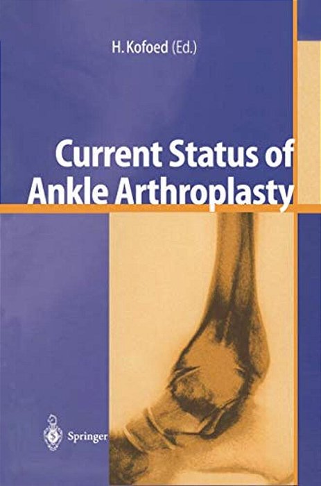 Current Status Of Ankle Arthroplasty-..