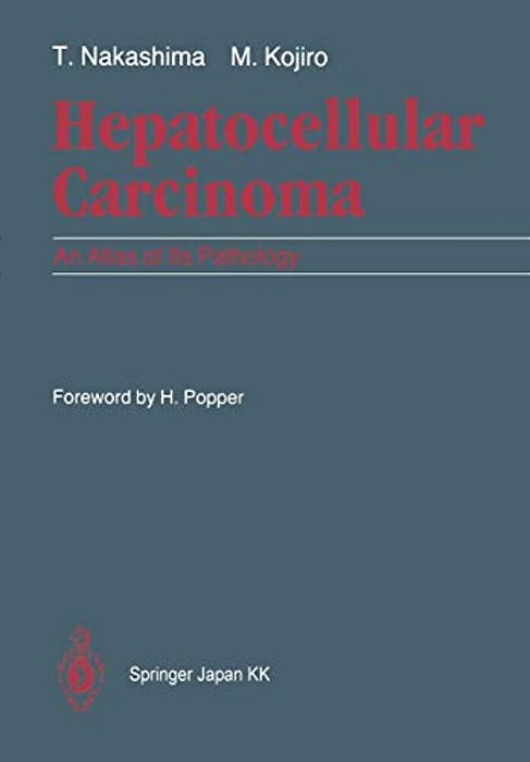 Hepatocellular Carcinoma: An Atlas Of Its Pathology-..