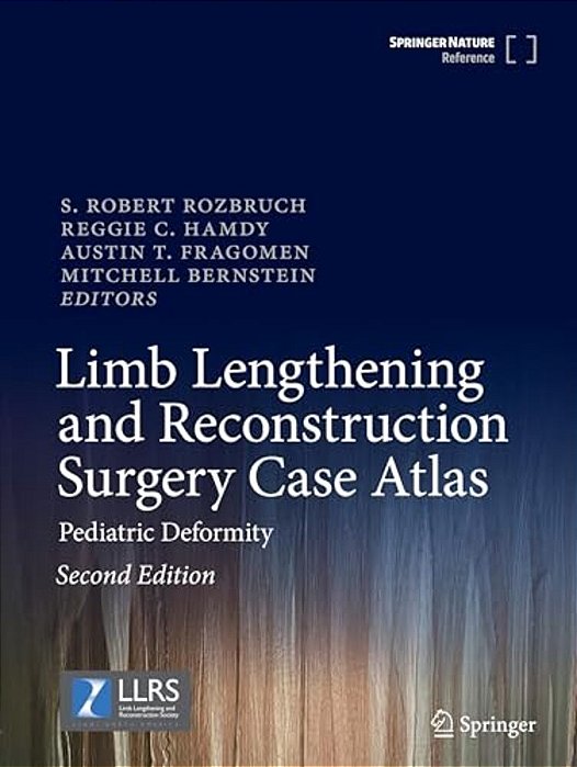 Limb Lengthening And Reconstruction Surgery Case Atlas: Pediatric Deformity-..