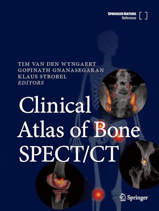 Clinical Atlas Of Bone Spect/Ct-..