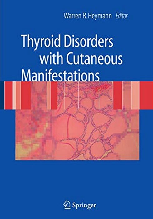 Thyroid Disorders With Cutaneous Manifestations-..