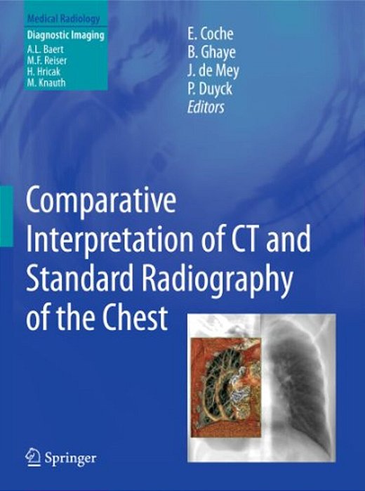 Comparative Interpretation Of Ct And Standard Radiography Of The Chest-..