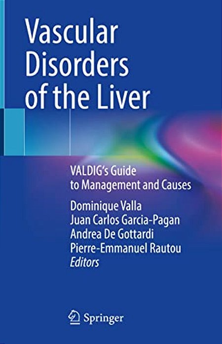 Vascular Disorders Of The Liver: Valdig's Guide To Management And Causes-..