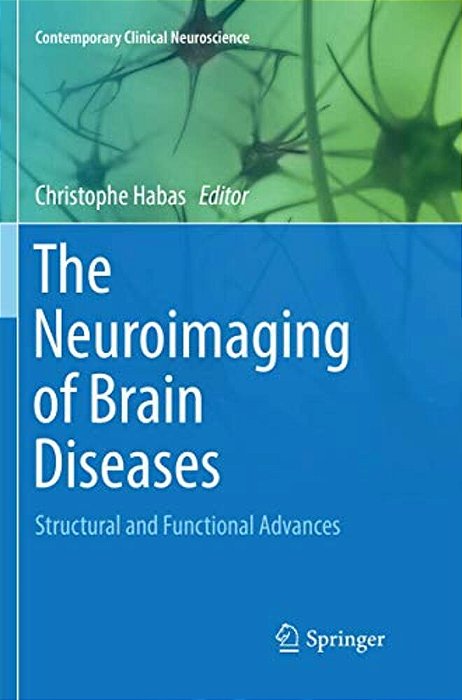 The Neuroimaging Of Brain Diseases: Structural And Functional Advances-..