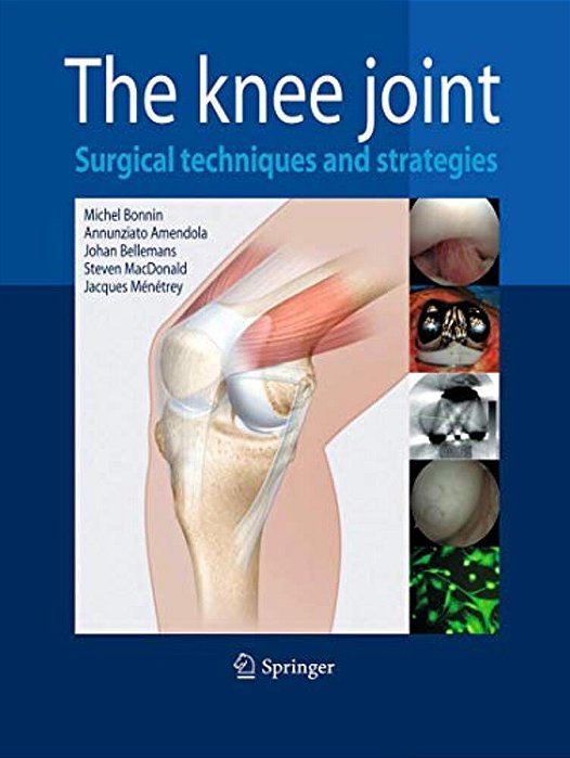 The Knee Joint: Surgical Techniques And Strategies-..