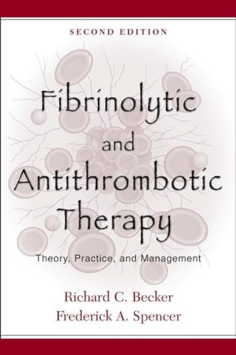 Fibrinolytic And Antithrombotic Therapy: Theory, Practice, And Management-..