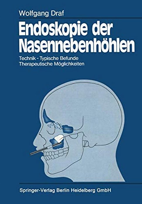 Endoskopie Der Nasennebenhöhlen: Technik - Typische Befunde, Therapeutische Möglichkeiten-..