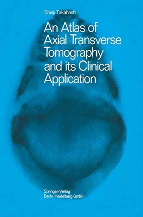 An Atlas Of Axial Transverse Tomography And Its Clinical Application-..