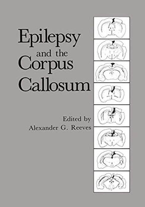 Epilepsy And The Corpus Callosum-..