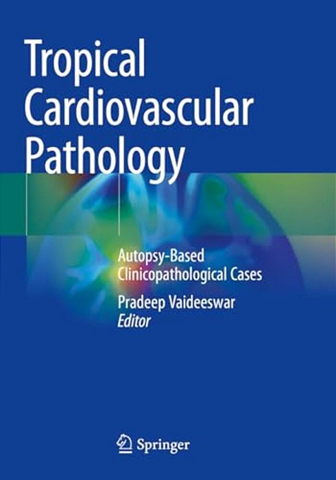 Tropical Cardiovascular Pathology: Autopsy-Based Clinicopathological Cases-..