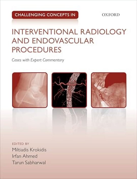 Challenging Concepts In Interventional Radiology-..
