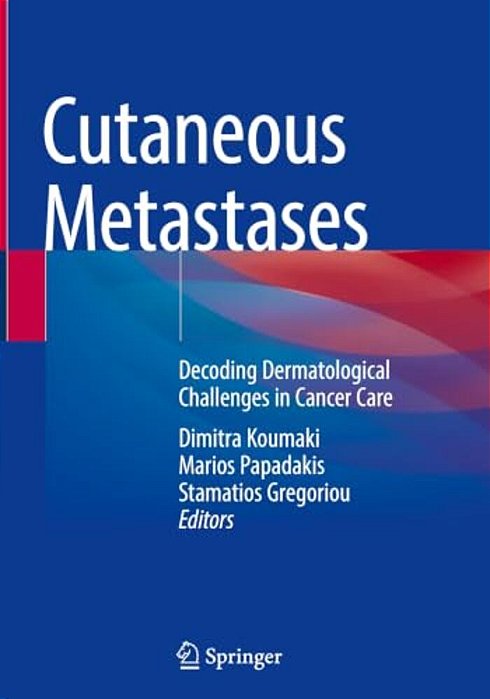 Cutaneous Metastases: Decoding Dermatological Challenges In Cancer Care-..