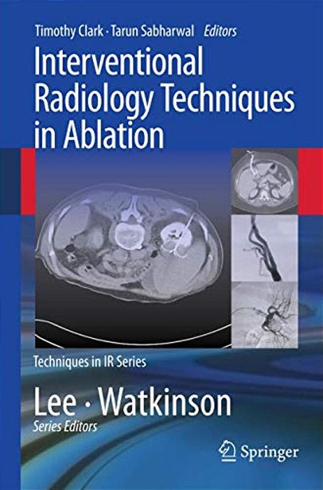 Interventional Radiology Techniques In Ablation-..